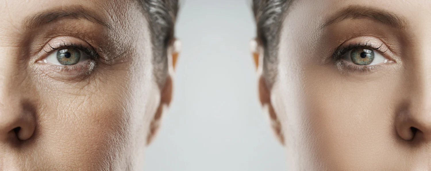 What Is the Difference Between CJC-1295 With DAC and Without DAC?