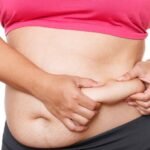 Liposuction