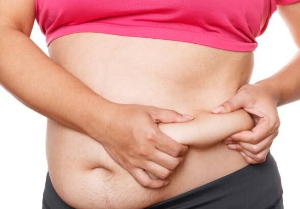 Liposuction