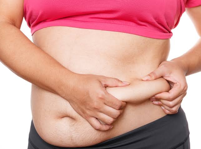 Liposuction